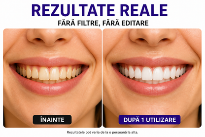 OraSmile™ – Benzi pentru Albirea Dinților în 30 Minute
